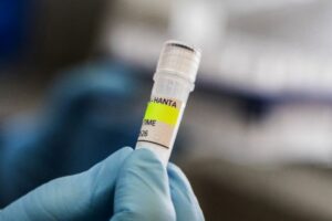 UK identifies new suspected hantavirus case on remote island